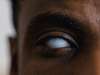 Can Weak Eye Muscles Cause Blindness
